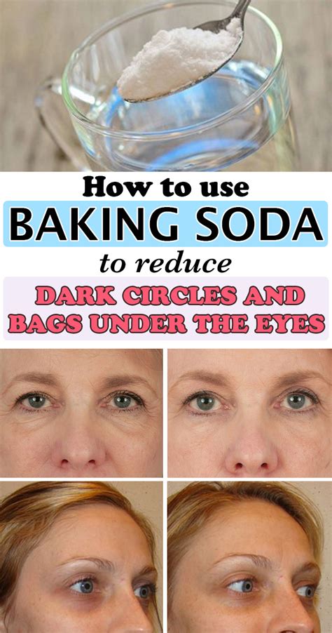 How To Use Baking Soda To Reduce Dark Circles And Bags Under The Eyes