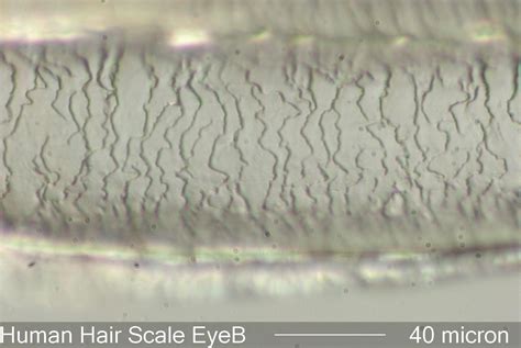Human Hair Under Microscope
