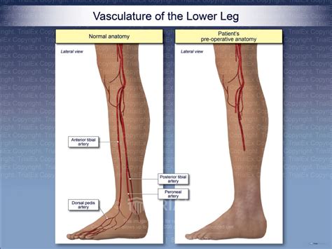 Vasculature Of The Lower Leg Trialexhibits Inc