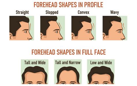 Prominent Supraorbital Ridge