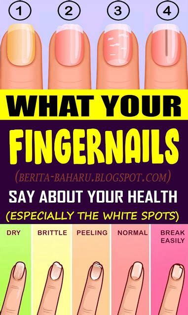 What Your Fingernails Say About Your Health Berita Baharu Natural