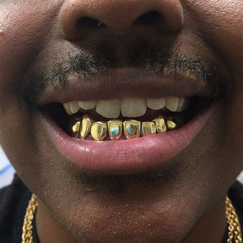 Check spelling or type a new query. Pin on #teeth