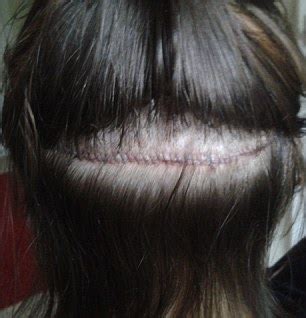 It will look bulkier at the roots and thinner on the ends, streicher says. Getting Your Hair Thinned Before And After