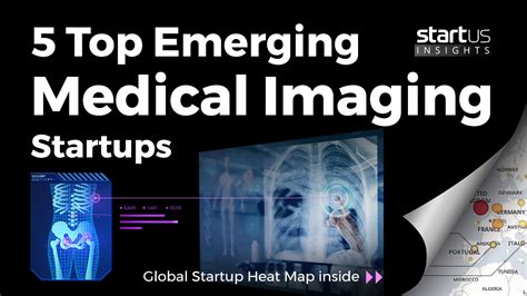 5 Top Medical Imaging Startups Impacting The Healthcare Sector