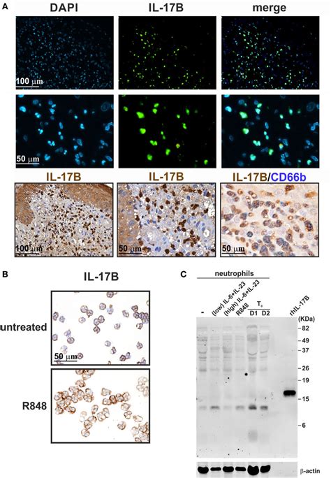 Staining Human Neutrophils By Anti Il 17b Af1248 Antibodies Abs