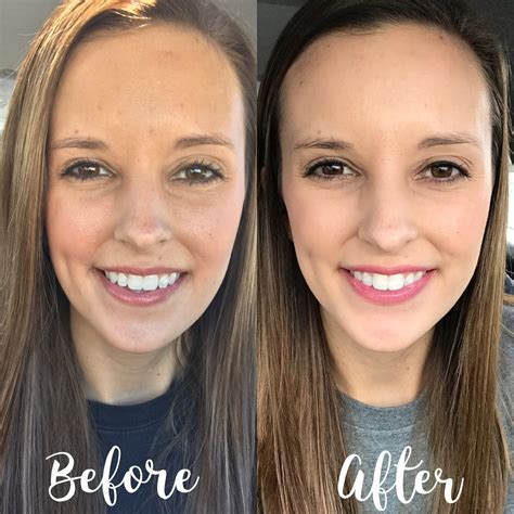 Before And After Using Senegence Skin Care No Filter And No Edits Made
