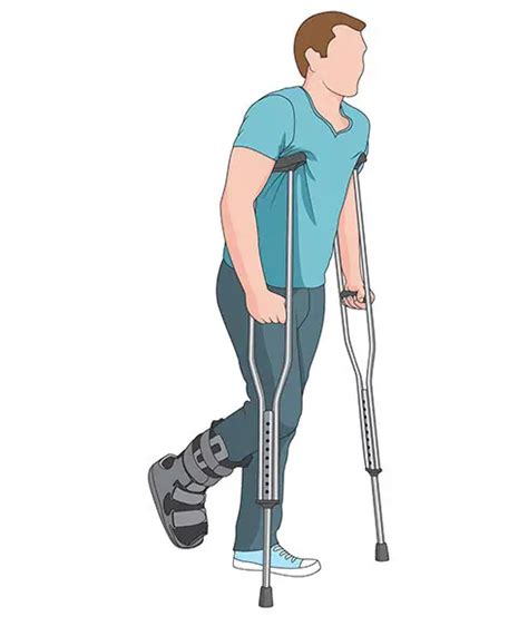 How To Walk On Crutches With A Broken Ankle Self Health Care