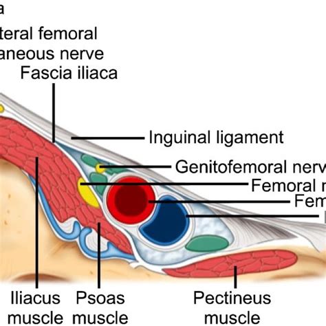 Schematic Diagram Showing The Pathway Of Ilioinguinal Iliohypogastric
