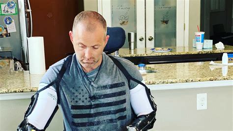Florida Man Lost His Arms And Legs But Refuses To Quit Running