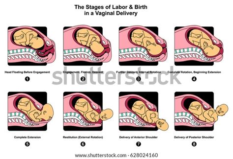 Stages Labor Birth Vaginal Delivery Infographic Stock Illustration 628024160