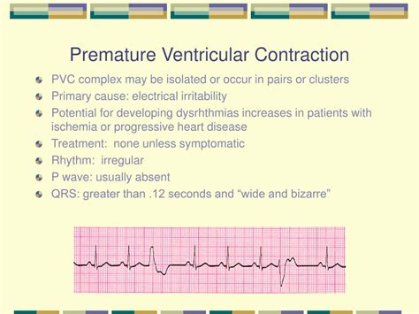 Premature Ventricular Contractions Causes