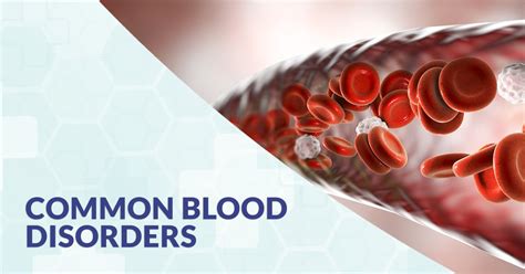 Common Blood Disorders Cfch Centre For Clinical Haematology
