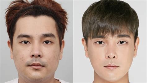 Male Cosmetic Surgery In China Men Do It To Get A Job Find A Date Or Feel More Confident Today