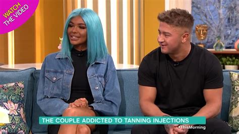 Couple Addicted To Tanning Injections Horrified By Terrifying Health
