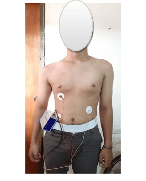 The Holter Monitor Electrode Placement Front View Download