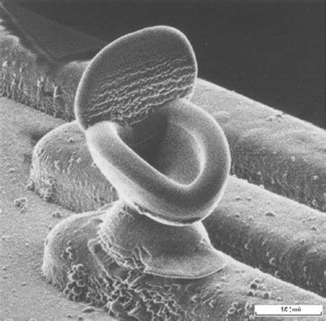 Amazing Electron Microscope Images Page 2