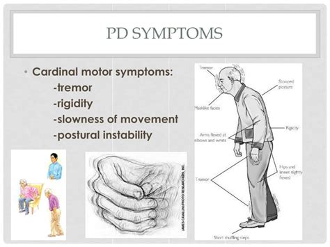 Ppt Parkinsons Disease Powerpoint Presentation Free Download Id