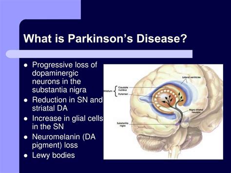 Ppt Bdnf And Parkinsons Disease Powerpoint Presentation Free