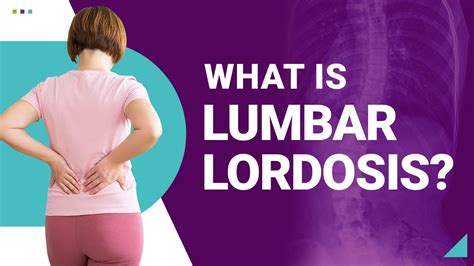 What Is Lumbar Lordosis Youtube
