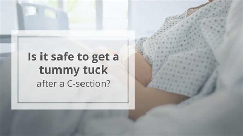 Tummy Tuck After C Section Is It Safe