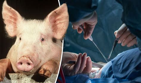 Pig Organs To Be Used Transplants Into People In Just Two Years
