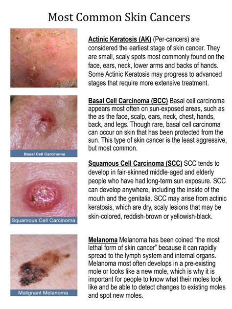 Rare Skin Cancer Types