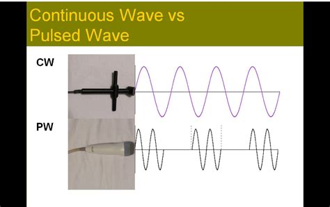 Production Of Sound Waves Ultrasound Registry Review