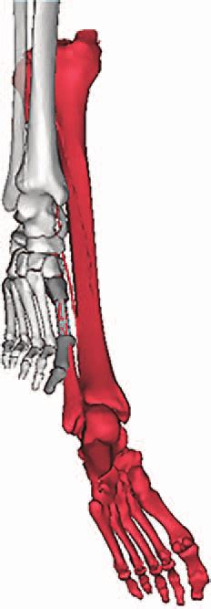 The Fibula Osteocutaneous Flap Was Virtually Inset Into The Proximal
