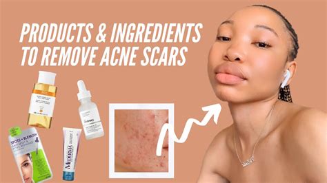 How To Get Rid Of Acne Scars Dark Spots Hyperpigmentation Youtube