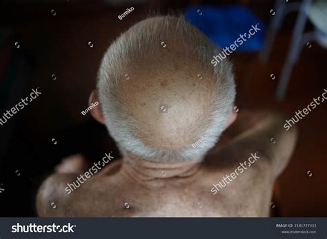 Hair Loss Men Bald Head Old Stock Photo 2181727333 Shutterstock