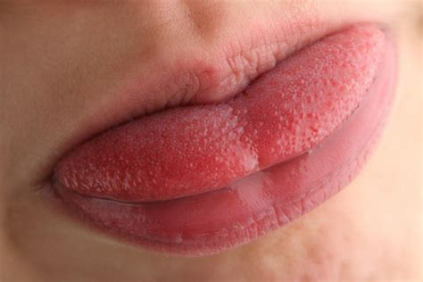What causes inflamed taste buds on tip of tongue. Swollen taste buds: Causes, diagnosis, and treatment