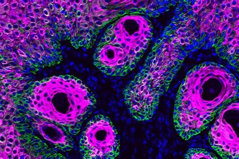 Cancer Stem Cells Reliance On A Key Amino Acid Could Be An Exploitable