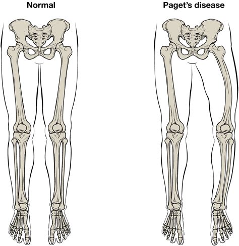 Bone Structure · Anatomy And Physiology