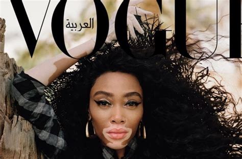 Winnie Harlow Lands New Vogue Cover Im Crying Right Now