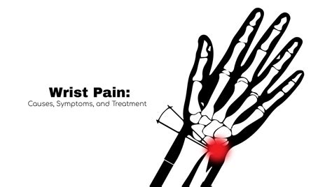 Wrist Pain Causes Symptoms And Treatment ~ Stat Cardiologist