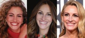 Julia Roberts Plastic Surgery Before And After Pictures 2024