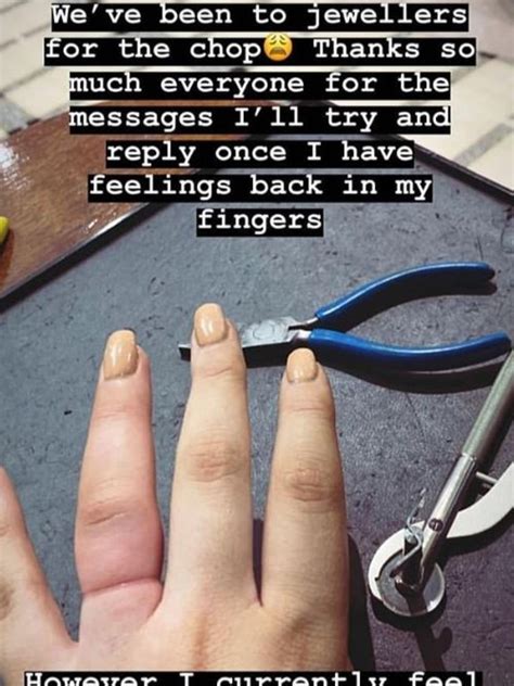 Woman Has 898k Engagement Ring Cut Off Her Swollen Finger Herald Sun