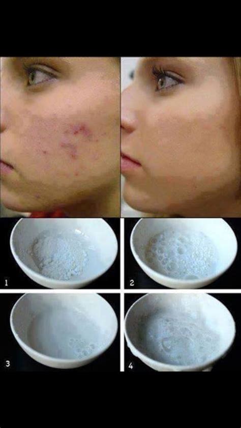 Natural Scar Remover Musely