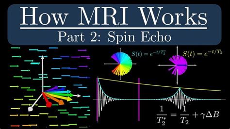 How Mri Works Part 2 The Spin Echo Mri It Works Echo