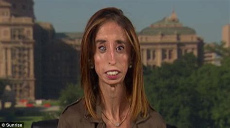 how world s ugliest woman lizzie velasquez fought back against the bullies daily mail online