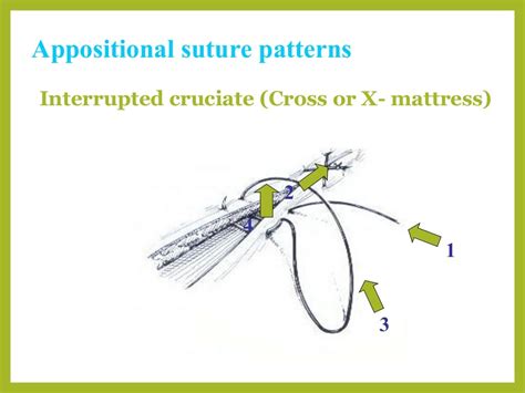 Basic Suture Patterns