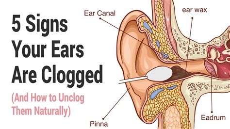 5 Signs Your Ears Are Clogged And How To Unclog Them Naturally