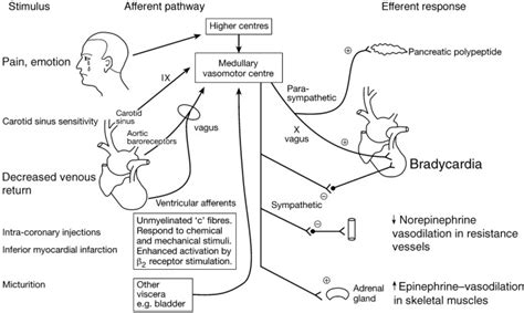 Perioperative Bradycardia And Asystole Relationship To Vasovagal