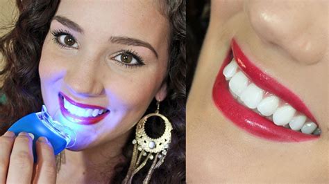 White And Bright Teeth Whitening Review Teethwalls