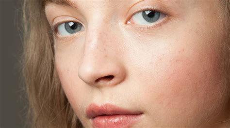 Notice how your skin feels. Sensitive Skin: What Causes It and the Best Way to Treat ...