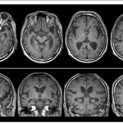 Brain Magnetic Resonance Imaging Brain Magnetic Resonance Imaging Download Scientific Diagram