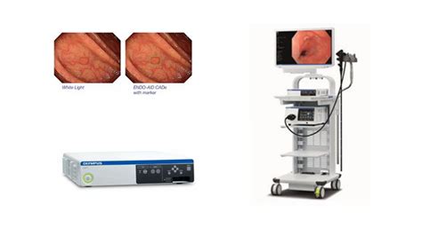 Olympus Launches Endo Aid An Ai Powered Platform For Its Endoscopy
