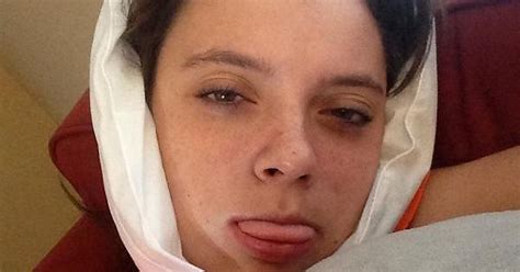 Wisdom Teeth Out 5 Days Before School Cant Feel Me Tongue Or Chin