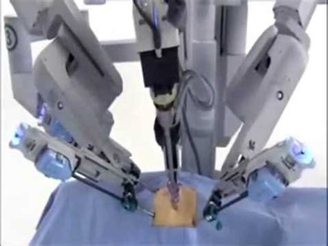 DaVinci Robotic Prostatectomy Procedure YouTube