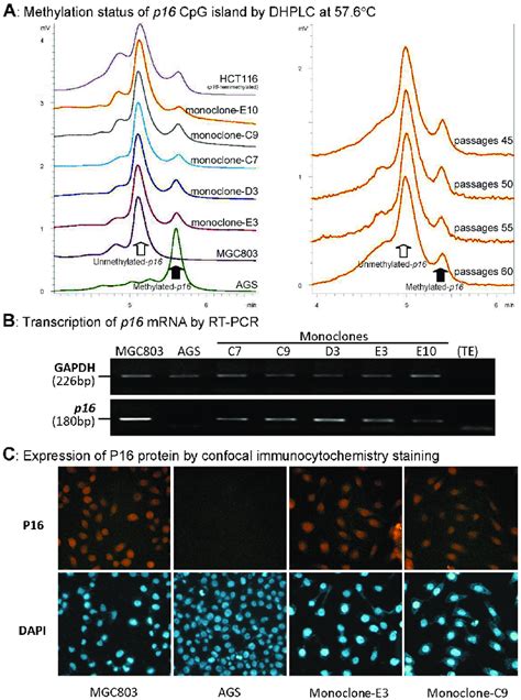 Characterization Of Methylation And Expression Of P16 In The Fusion